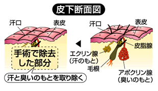 sec3_image